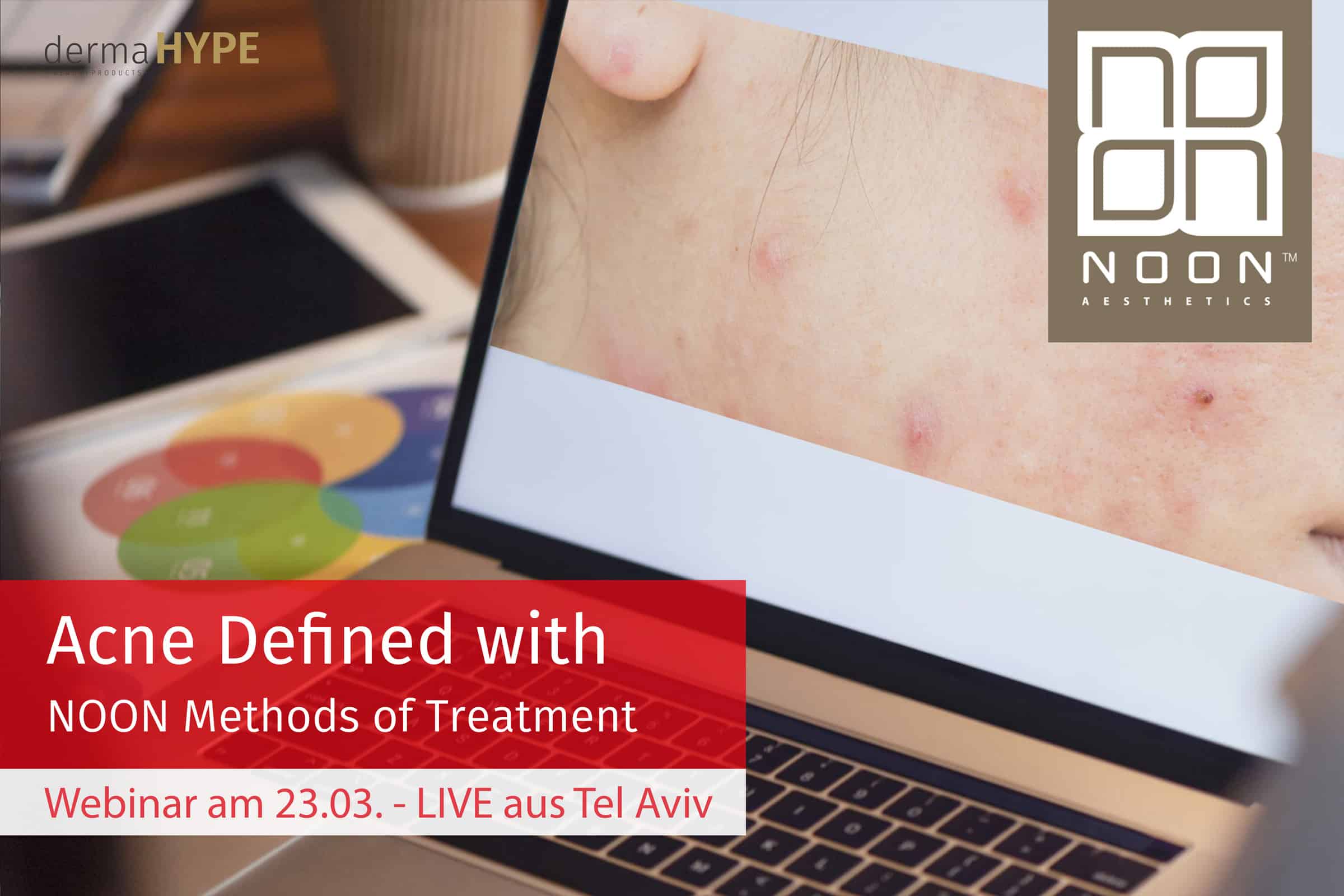 Beitragsbild-Webseite+LinkedIN-Webinar-Akne