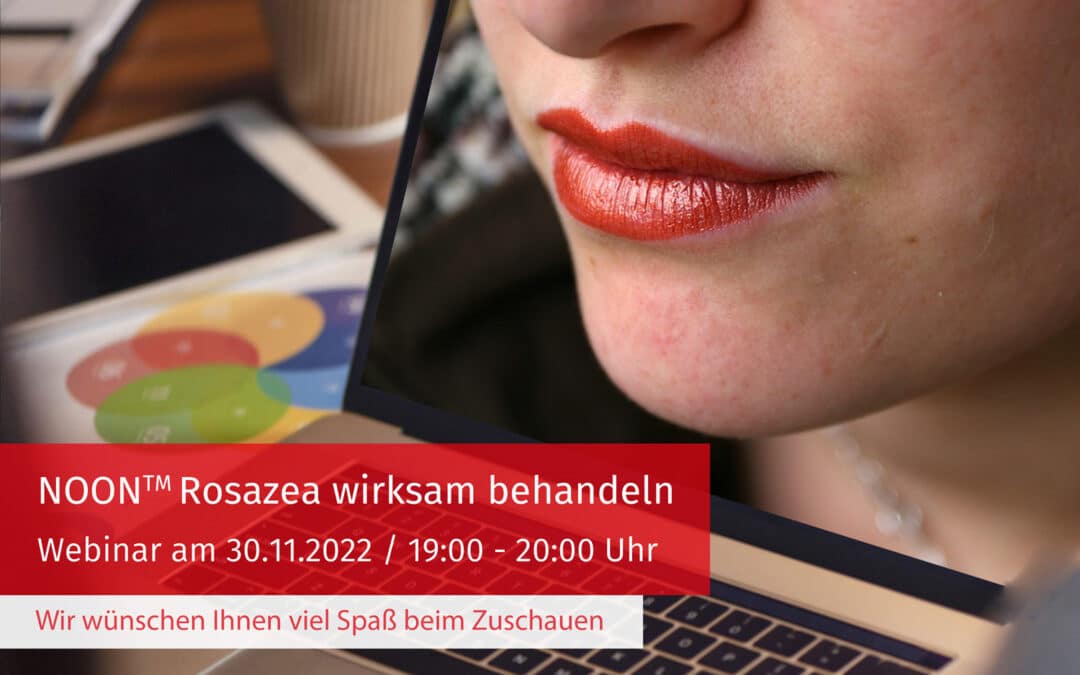 NOON2gether – Unser Webinar zur Behandlung von Rosazea – LIVE aus Kassel!