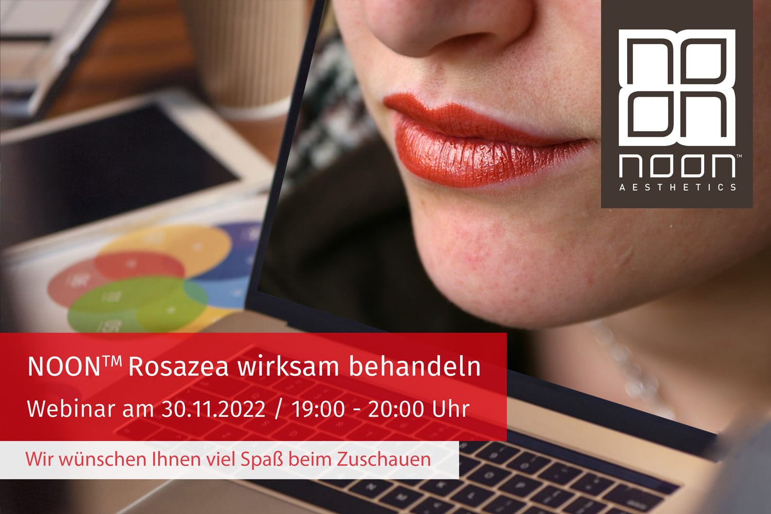 Beitragsbild-Webseite+LinkedIN-Webinar-Rosazea
