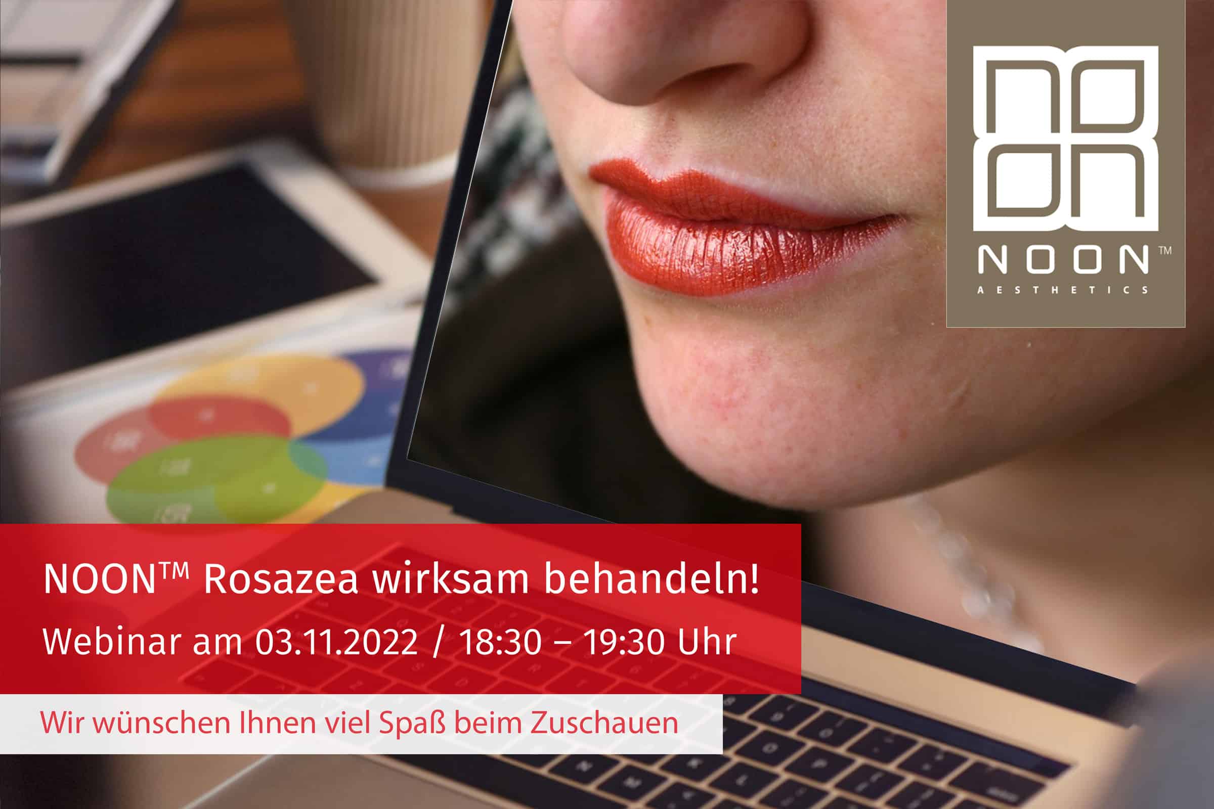 Beitragsbild-Webseite+LinkedIN-Webinar-Rosazea